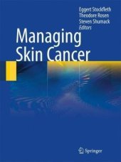 book Managing Skin Cancer