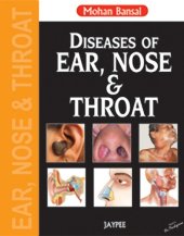 book Diseases of Ear, Nose and Throat