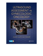 book Ultrasound assessment in gynecologic oncology