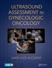 book Ultrasound assessment in gynecologic oncology