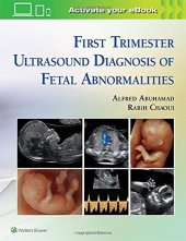 book First Trimester Ultrasound Diagnosis of Fetal Abnormalities