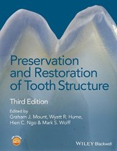 book Preservation and Restoration of Tooth Structure