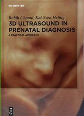 book 3D Ultrasound in Prenatal Diagnosis: A Practical Approach