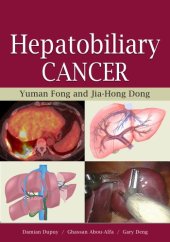 book Hepatobiliary Cancer