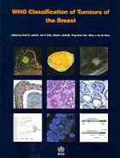 book WHO classification of tumours of the breast