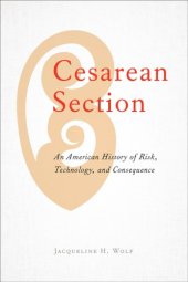 book Cesarean Section: An American History of Risk, Technology, and Consequence