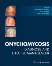 book Onychomycosis : diagnosis and effective management