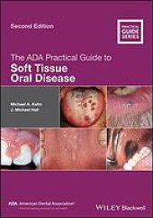 book The ADA practical guide to soft tissue oral disease