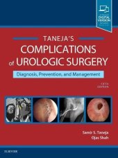 book Complications of Urologic Surgery: Prevention and Management