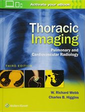 book Thoracic Imaging: Pulmonary and Cardiovascular Radiology