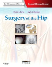 book Surgery of the Hip: Expert Consult