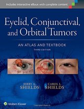 book Eyelid, Conjunctival, and Orbital Tumors: An Atlas and Textbook