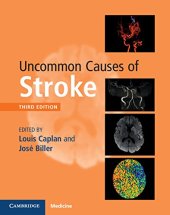 book Uncommon Causes of Stroke