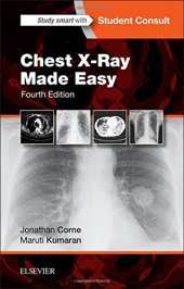 book Chest X-Ray Made Easy