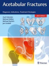 book Acetabular Fractures: Diagnosis, Indications, Treatment Strategies