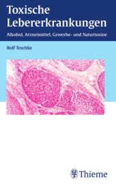 book Toxische Lebererkrankungen : Alkohol, Arzneimittel, Gewerbe- und Naturtoxine