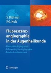 book Fluoreszenzangiographie in der Augenheilkunde : Fluoreszein-Angiographie, Indozyaningrün-Angiographie und Fundus-Autofluoreszenz