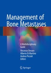 book Management of Bone Metastases