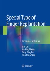 book Special Type of Finger Replantation