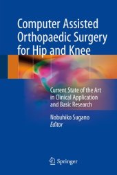 book Computer Assisted Orthopaedic Surgery for Hip and Knee