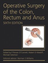 book Operative Surgery of the Colon, Rectum and Anus. by L. Peter Fielding, Ronan O'Connell, Robert Madoff