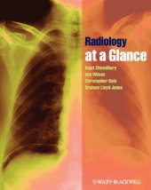 book Radiology at a Glance.