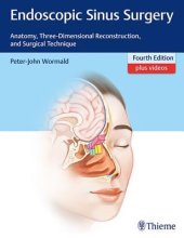 book Endoscopic Sinus Surgery: Anatomy, Three-Dimensional Reconstruction, and Surgical Technique