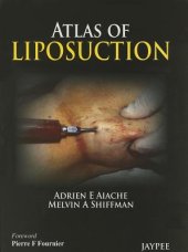 book Atlas of Liposuction