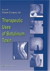 book Therapeutic Uses of Botulinum Toxin (Musculoskeletal Medicine)