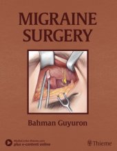 book Migraine surgery