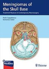 book Meningiomas of the skull base : treatment nuances in contemporary neurosurgery