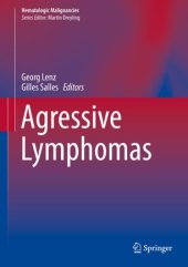 book Agressive Lymphomas