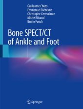 book Bone SPECT/CT of Ankle and Foot