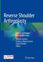 book Reverse Shoulder Arthroplasty: Current Techniques and Complications