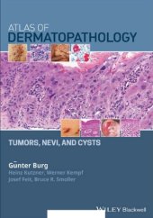 book Atlas of dermatopathology : tumors, nevi, and cysts