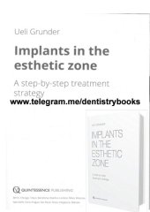 book Implants in the esthetic zone : a step-by-step treatment strategy