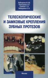 book Телескопические и замковые крепления зубных