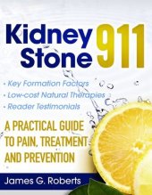 book Kidney Stone 911: A Practical Guide to Pain, Treatment and Prevention