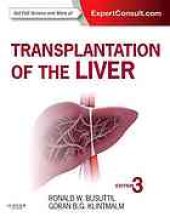 book Transplantation of the liver