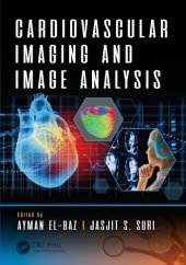 book Cardiovascular imaging and image analysis