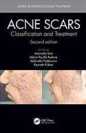 book Acne scars: classification and treatment