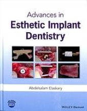 book Advances in esthetic implant dentistry