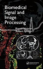 book Biomedical signal and image processing