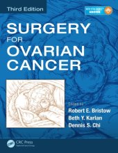 book Surgery for ovarian cancer