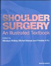 book Shoulder surgery: an illustrated textbook