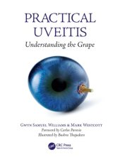 book Practical uveitis