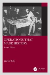 book Operations that made history