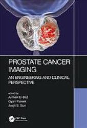 book Prostate cancer imaging : an engineering and clinical perspective