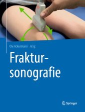 book Fraktursonografie