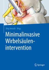 book Minimalinvasive Wirbelsäulenintervention